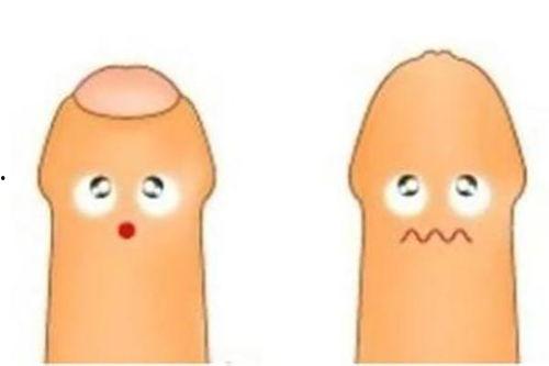 成人包皮恢复过程视频